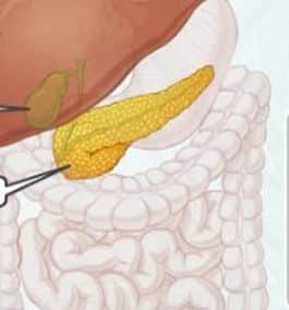 Understanding the pancreas