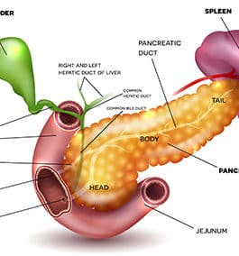 Complications of chronic pancreatitis