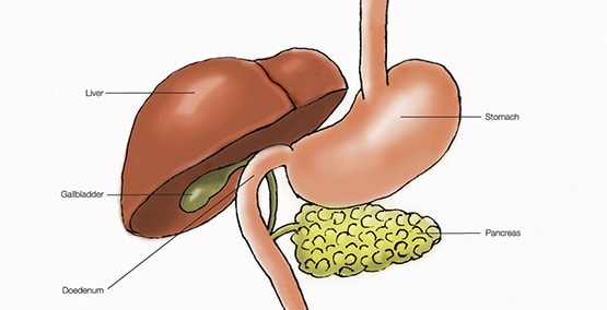 Causes of chronic pancreatitis