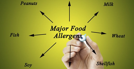 List of major food allergies